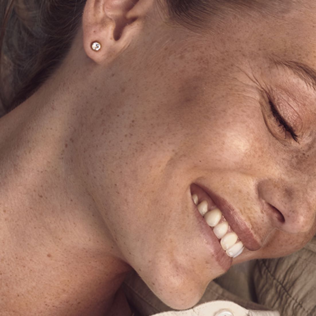 Alergia na nikiel – wybieramy najzdrowszy materiał na biżuterię